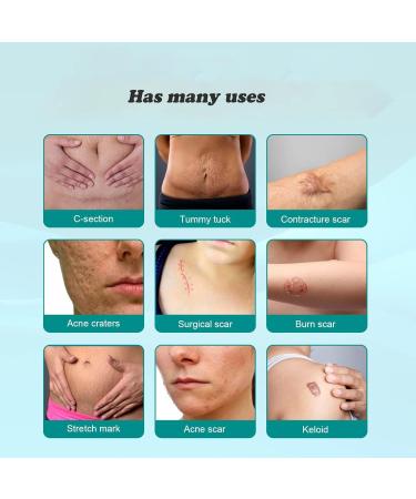 Scar Removal Spray- Advanced Formula for All Types of Scars - 2PCS - Buy Online on GoSupps.com