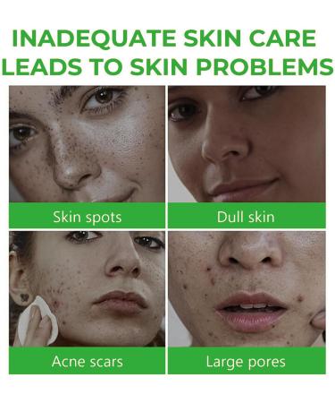 Brightening Face Wash Niacinamide Blemish Control Cleanser Facial Cleanser Acne Face Wash For Acne Prone Skin Deep Foaming Cleanser Face Wash For Oily Skin Acne Scars Dark Spots Freckle - Buy Online on GoSupps.com