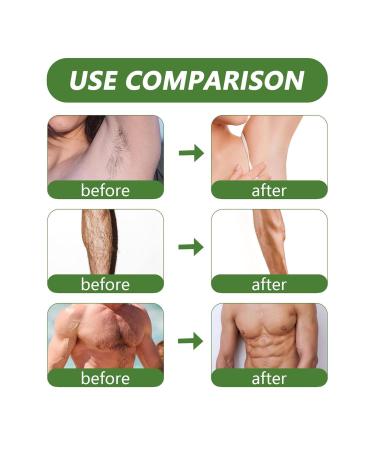 Pain-Free Pearl Wax for Hair Removal | Aloe Vera Hard Wax Pearls for Sensitive Skin Perfect for Bikini Legs Arms & More - Buy Online on GoSupps.com