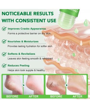  ARCHIDATE Urea 60% Foot Care Cream Fast-absorbing urea cream with aloe vera for dry and rough skin on feet hands and elbows (aloe vera) - Buy Online on GoSupps.com
