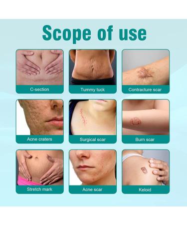 Advanced Scar Spray for All Types of Scars - Gentle Acne Scar Treatment for Face - Skin Care for Acne Prone Skin - 2PCS - Buy Online on GoSupps.com