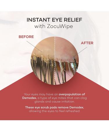 Zocular Zocuwipe Eyelid Wipes with Okra Complex - 30ct + Zocufill Elixir Eye Gel and Face Serum - Buy Online on GoSupps.com