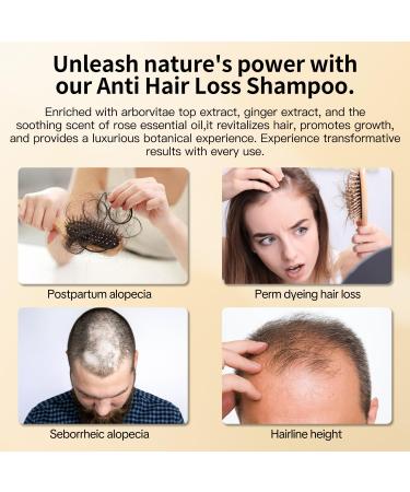 Anti Hair Loss Shampoo - Nourishing Ginger Hair Growth Treatment for Men & Women | Volumizing Regrowth with Herbal Essences Rose & Castor Oil - 16.8 fl. oz - Buy Online on GoSupps.com