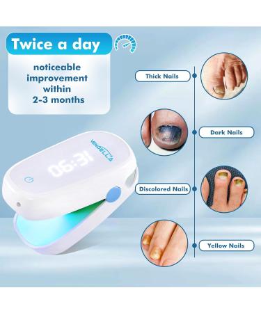 VENDELLA Nail Fungus Laser Treatment Device Portable Light Therapy Fungus Nail Treatment Toenail Fungus Treatment with Blue & Infrared Light Home-Use for Damaged Discolored Thickened Fingernails - Buy Online on GoSupps.com