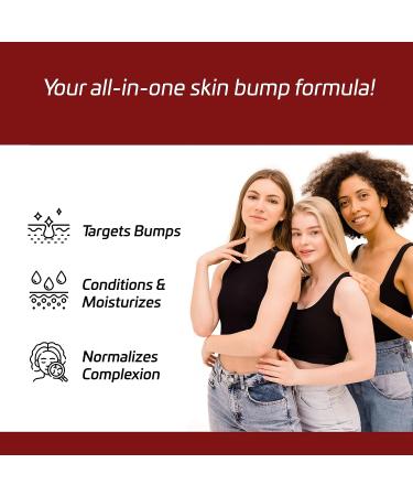 BUMP TERMINATOR Extra Strength Severe Bumps Lotion 6.8 fl oz by Breej - Effective Treatment for Razor Bumps 200ml - Buy Online on GoSupps.com