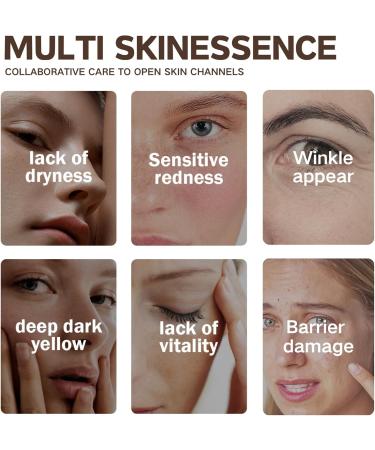 Snail Mucin Cream -Anti Wrinkle Face cream - Night Cream for Women Anti Aging - Moisturiser for Face Care - Deep Hydrating - Skin Care Products - Buy Online on GoSupps.com