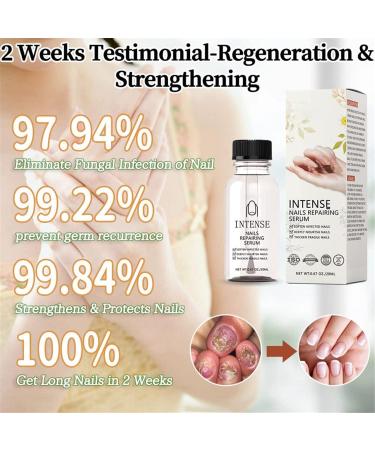 NailGro Intense Nail Growth and Strengthening Serum 7 Days Nail Growth and Strengthening Serum Natural Nail Repair Serum for Thin Nails and Growth 20ml (1Pcs) - Buy Online on GoSupps.com