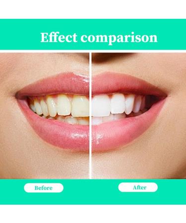 Katyjun 2PC Mouthwash & Teeth Whitening Toothpaste - Total Care for Healthy Smile | International Shipping - Buy Online on GoSupps.com