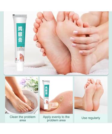 JIEJIEHOUSE Anticallus cream anticorn skin ointment corn remover callus remover foot gel against calluses and corns for women and men 20 g - Buy Online on GoSupps.com
