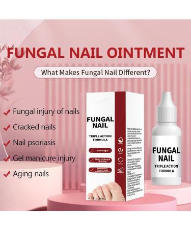 Whrcy Fingernail repair drops Damaged Hands Feet Nails Repair Solution 15ml Deep Hydration Booster with Precise Dropper for All Seasons Teens Adults Women - Buy Online on GoSupps.com