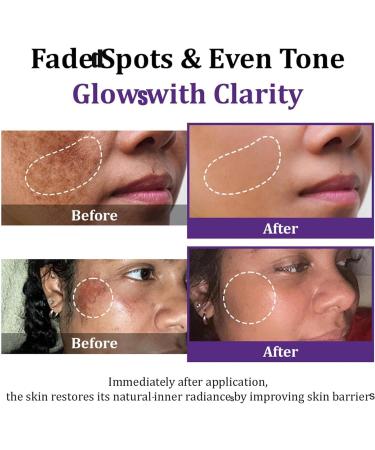 JIAOY EPIGLOW Advanced Pigmentation Cream Tone Correction Moisturizer EPIGLOW Pigmentation Treatment Cream AntiAging Face Removes Dark Spots Skin Buildup 6 Pack 6 Pack - Buy Online on GoSupps.com