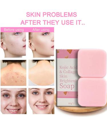 Kojic Acid Soap for Dark Spots - Natural Face Bar, Collagen Boost, Moisturize, Oil Control - Even Skin Tone - Buy Online on GoSupps.com
