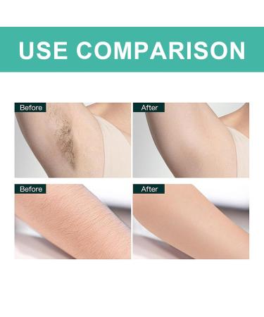 Wax Strips for Hair Removal - 20 Body Wax Strips & 10 Wet Wipes - Gentle & Safe for Sensitive Skin Legs Armpits | International Shipping - Buy Online on GoSupps.com