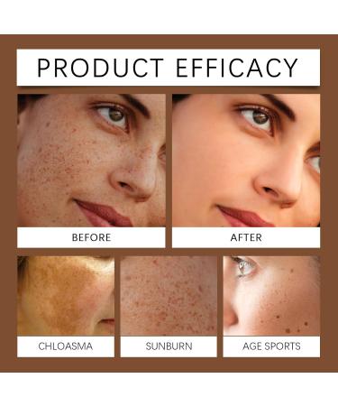 VKaoess Advanced AntiDark Spot Serum with Rollerball Supports Age and Sun Spots on Face and Body Cares for Uneven Tone and Dull Skin All Skin Types 5 Pack - Buy Online on GoSupps.com