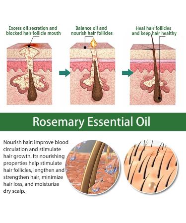 Rosemary Oil for Hair Growth Rosemary Hair Oil Rosemary Essential Oil for Hair Growth Wild Growth Hair Oil Improve Hair Loss and Nourishes Rosemary Scalp Oil for Women (60ML+2brush) - Buy Online on GoSupps.com