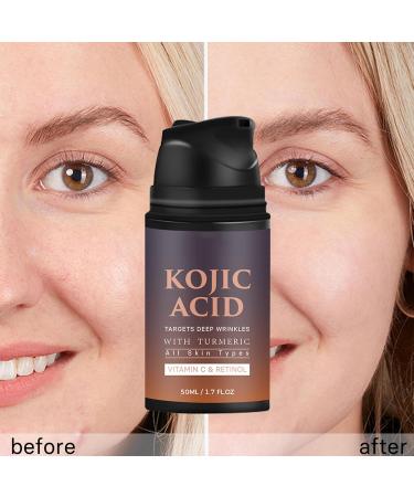 Kojic Acid Cream With Retinol Kojic Acid Retinol Face Cream Kojic Acid Vitamin C Face Cream Kojic Acid Face Cream Kojic Acid Cream Kojic Acid Cream Skin Lightening Cream - Buy Online on GoSupps.com