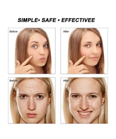 AIMENGXI Diamond Microdermabrasion Blackhead Remover Vacuum with LED Face Mask - 7 Colors LED Facial Skin Care Mask - Buy Online on GoSupps.com