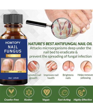 R paration des ongles | Renforcement des ongles pour ongles fins et croissance | Solution de r paration des ongles Renewal pour ongles d color s et ab m s Artiby - Buy Online on GoSupps.com