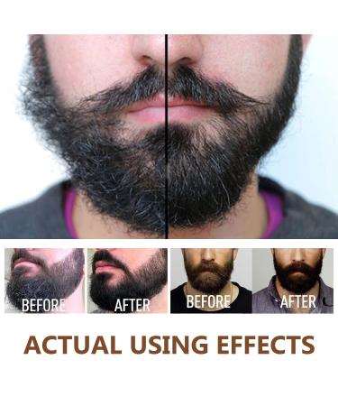 100% Natural Organic Beard Oil | Calming & Moisturizing Argan & Jojoba Oil for Men | Strengthen Beard Growth - Buy Online on GoSupps.com