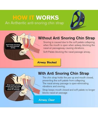 Crowndy Anti Snoring Chin Strap - Adjustable Stop Snoring Device for Men and Women - Buy Online on GoSupps.com