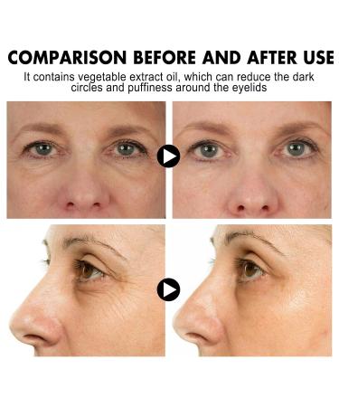 ARANYA Instant Eye Lift Eye Cream Anti-Aging Formula for Fine Lines Wrinkles Dark Circles and Puffiness Improves Skin Elasticity 30ML/1FL OZ - Buy Online on GoSupps.com