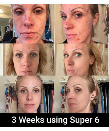 TR Skin Eye Serum - Plant Based Anti-Aging Treatment with Hyaluronic Acid | Reduces Dark Circles & Wrinkles | Organic Aloe Vera Skin Care - Buy Online on GoSupps.com