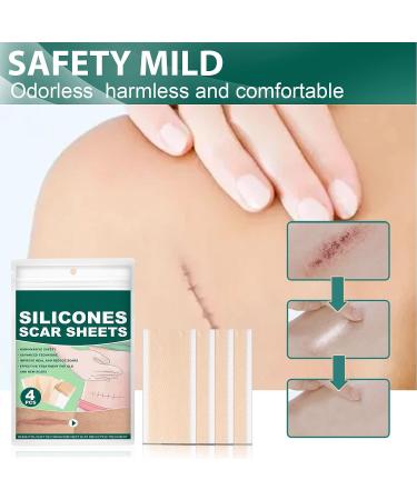 Professional Silicone Scar Removal Sheets - Reusable Gel Strips for Keloid, C-Section, Surgery, Burn, Acne - Stretch Marks Patch Away Tape - Buy Online on GoSupps.com