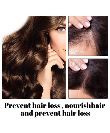 Handcrafted Rice Water & Aloe Vera Shampoo Bar for Hair Growth - 4.2oz - Buy Online on GoSupps.com