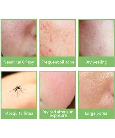 Mrcuvaryas 200ml Aloe Vera Gel 99.9% Pure Aloe Vera Gel For Face Organic Aloe Vera Gel Natural Aloe Vera Gel After Sun Hydrating Aloe Pura Gel For Dry Skin Sunburn Soothing & Moisturizing - Buy Online on GoSupps.com