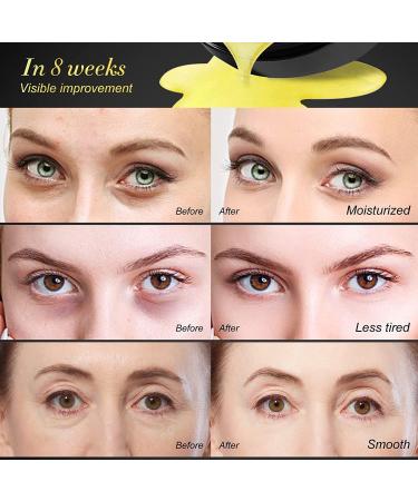 AIQIUSHA 30 Pairs Under Eye Treatment Masks Natural Gel Patch Lighten Dark Circles Collagen Eye Care Mask for Anti-Wrinkle Eye Bags Skin Care Moisturizing Soothing Firming - Buy Online on GoSupps.com