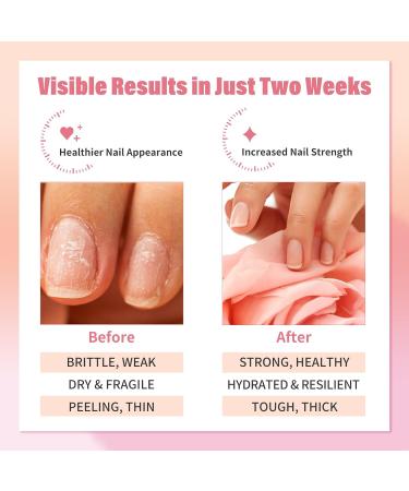 EJW Nail Strengthener Serum - Boost Nail Growth & Repair Weak Nails | Licorice Root Jojoba Oil Hyaluronic Acid (1.01 fl oz - Buy Online on GoSupps.com