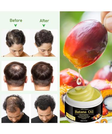 Organic Batana Oil for Hair Growth | Dr. Sebi Pure Hair Oil - Thicker Fuller Hair Prevents Loss & Repairs Split Ends | International Shipping - Buy Online on GoSupps.com