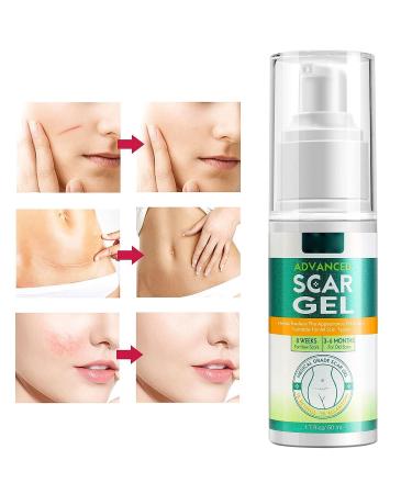 Scar Gel 50ml - For Burn, Surgical, Cesarean, Stretch Marks & Toenail Clippers - Old & New Scar Removal Cream - Buy Online on GoSupps.com
