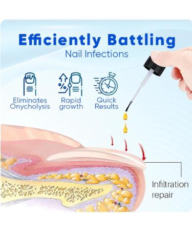 Onyxoguard Nail Growth And Repair Serum Onycholysisheal Nail Strengthening And Growth Conditioner Nail Growth And Strengthener Essence For Thin Nails And Growth (1PCS) - Buy Online on GoSupps.com