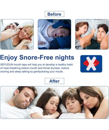 Kopana Mouth Tape - 60 Counts for Better Sleep | Sleep Tape for Improved Breathing during Sleep - Buy Online on GoSupps.com