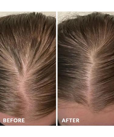 Shampoo Conditioner & Serum Set | Fermented Rice Water & Biotin | Hair Growth Repair Kit | Sulfate Free Vegan All Hair Types - Buy Online on GoSupps.com