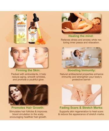 Frankincense Essential Oil Pure & Natural Premium Frankincense Oil for Face Hair Care Body Home Diffusers Aromatherapy Massage and Humidifiers 2.02 Fl.Oz/60 ML 2.02 Fl Oz (Pack of 1) - Buy Online on GoSupps.com