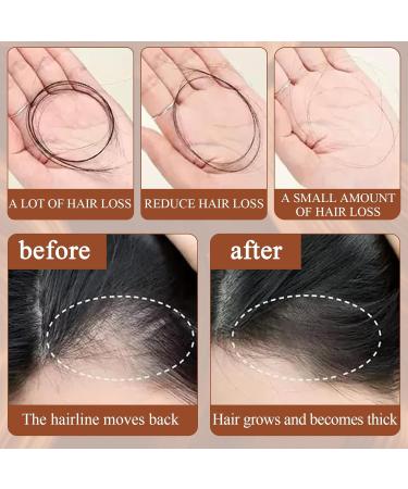 Batana Oil for Hair Growth Raw Batana Oil Organic Batana Oil for Hair Growth Repair Damaged Hair Batana Oil Hair Treatment for All Hair Types 120ml - Buy Online on GoSupps.com