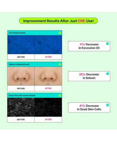 EDIT.B Calming Tok CICA Heartleaf Trouble Pad + Cream Duo | Cooling & Soothing Skincare Bundle for Sensitive Skin - Buy Online on GoSupps.com