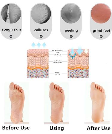 Moisturizing Socks 2 Pair Silicone Anti-split Moisturizing Socks Soft Breathable Foot Care Gel SPA Socks for Women and Men Foot Anti-cracking Protector for Dry Feet Ankles Cracked Heel Repair Large - Buy Online on GoSupps.com