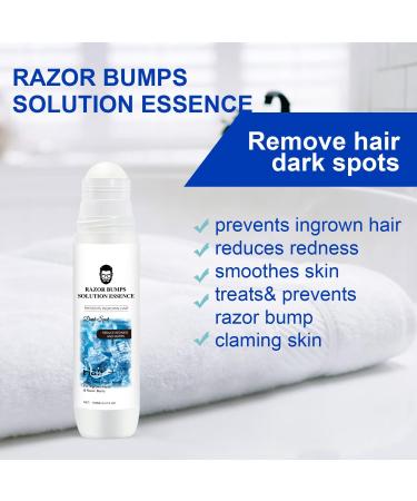  EverestBeauty Razor Bump Ingrown Hair Treatment Solution 100ml - Buy Online on GoSupps.com