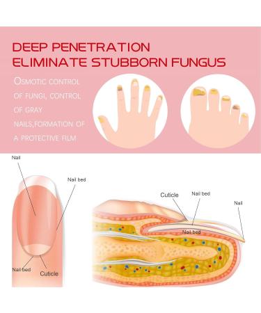 Cuticle and Nail Oil Nail Repair for Growth - Gentle Nail Cuticle Oil Nail Hardener Nail Growth Polish for Adults Teksome - Buy Online on GoSupps.com