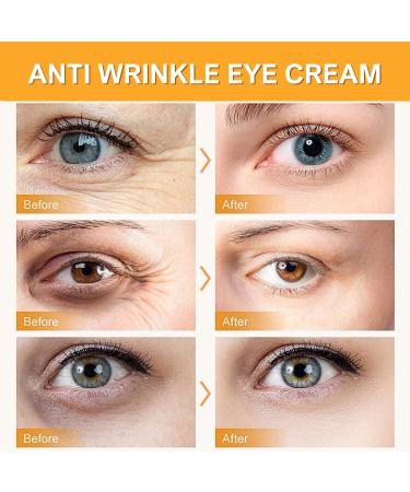Turmeric Eye Cream Anti Aging Eye Cream With Vitamin C Eye Cream For Dark Circles And Puffy Eyes Turmeric Cream For Radiant&Glowing Skin Under Eye Cream Dark Circle Eye Cream All Skin Types - Buy Online on GoSupps.com
