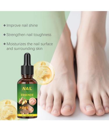 Essence pour les ongles l'huile de racine de gingembre - S rum pour un tat sain des ongles un renforcement et une brillance une cuticule hydratante une utilisation douce (6pcs) - Buy Online on GoSupps.com