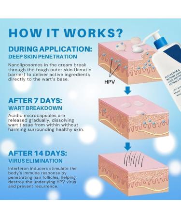 Cr me Apaisante Intime une cr me professionnelle pour hommes contre les verrues apaisante et hydratante. 2PCS - Buy Online on GoSupps.com