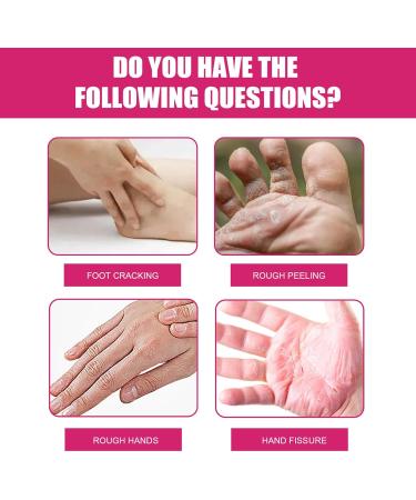 Gel Moisture Gloves Moisturizing Gloves That Soften Rough Skin Washable for Dry Hands - Buy Online on GoSupps.com