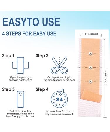 Silicone Scar Sheets - Reusable & Effective for Scar Removal - Pack of 6 Silicone Removal Strips for Surgical Scars, Keloids, C-Section, Tummy Tuck - Scar Tape - Buy Online on GoSupps.com