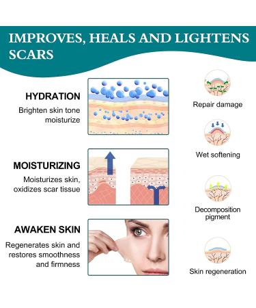 Silicone Scar Sheets - Professional Tape for Surgical Scars | C-Section, Burn, Keloid, Acne | 16 Pads (5.9 x 1.6) - Scar Removal Strips - Buy Online on GoSupps.com