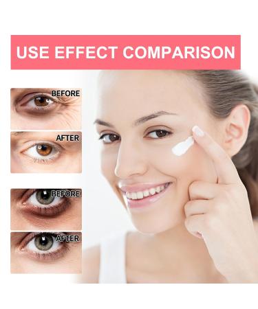 Retinol Eye Serum Stick & Cream | Anti-Aging Eye Treatment for Youthful Skin - Buy Online on GoSupps.com