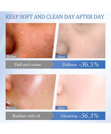 Buy Rice Face Cleanser - Hydrating Foaming Wash with Vitamin B3 for Dry Skin | Gentle Soothing & Oil Control | International Shipping Available - Buy Online on GoSupps.com